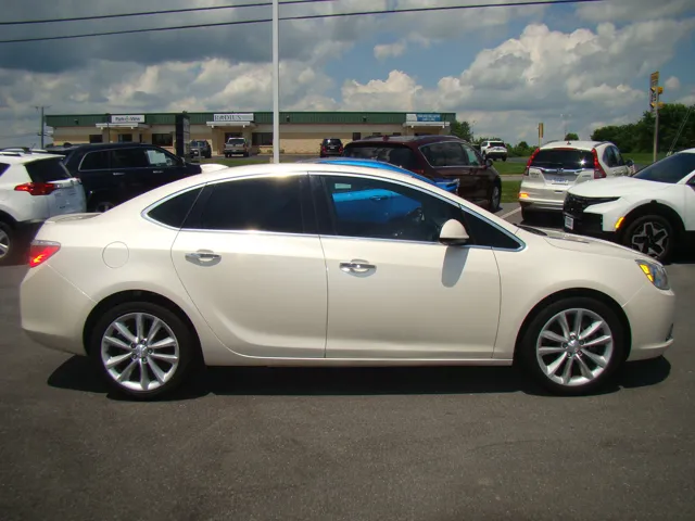 2016 Buick Verano 1SL's photo